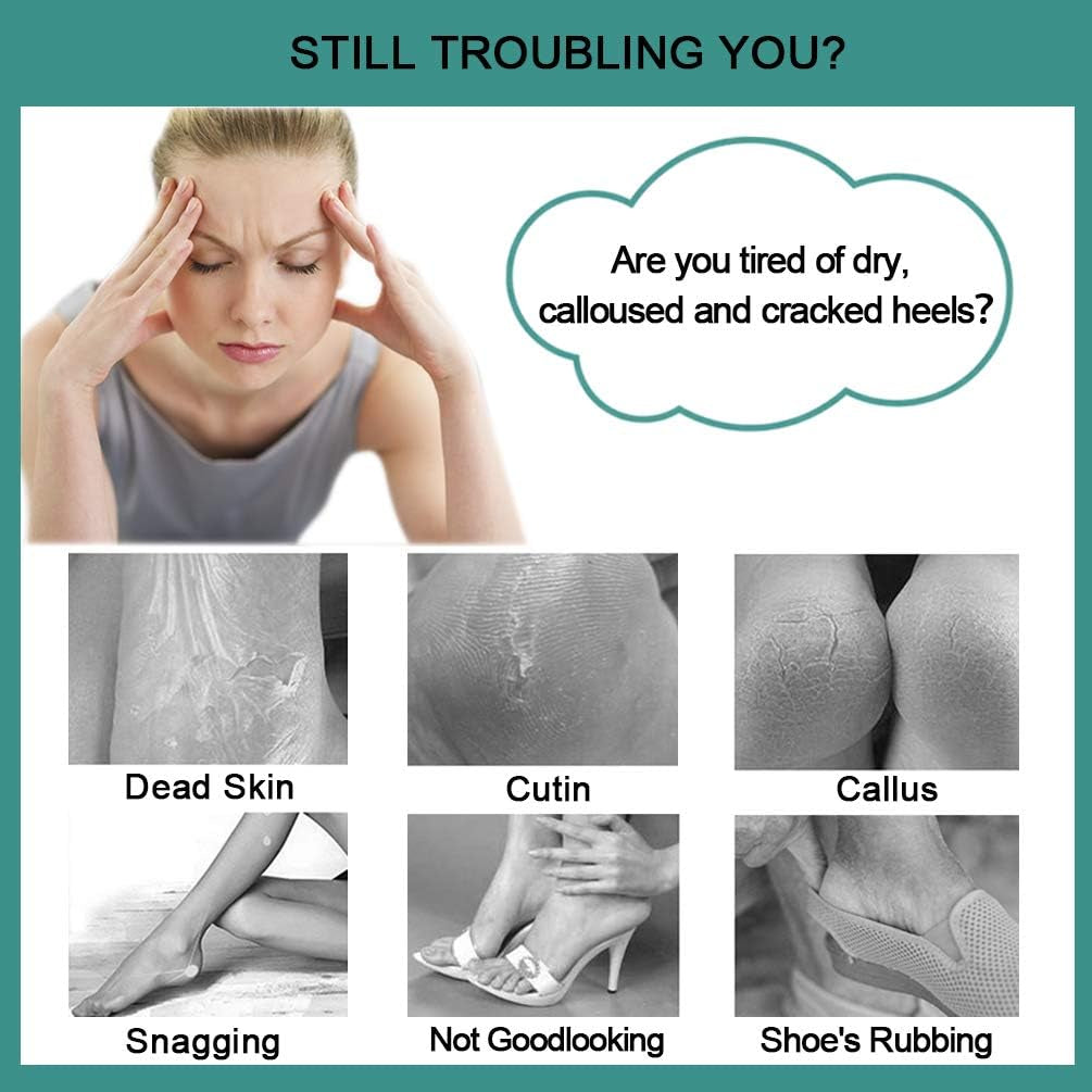 Foot File Callus Remover - Multi Purpose 4 in 1 Feet Pedicure Tools with Foot Scrubber, Pumice Stone, Foot Rasp and Sand Paper