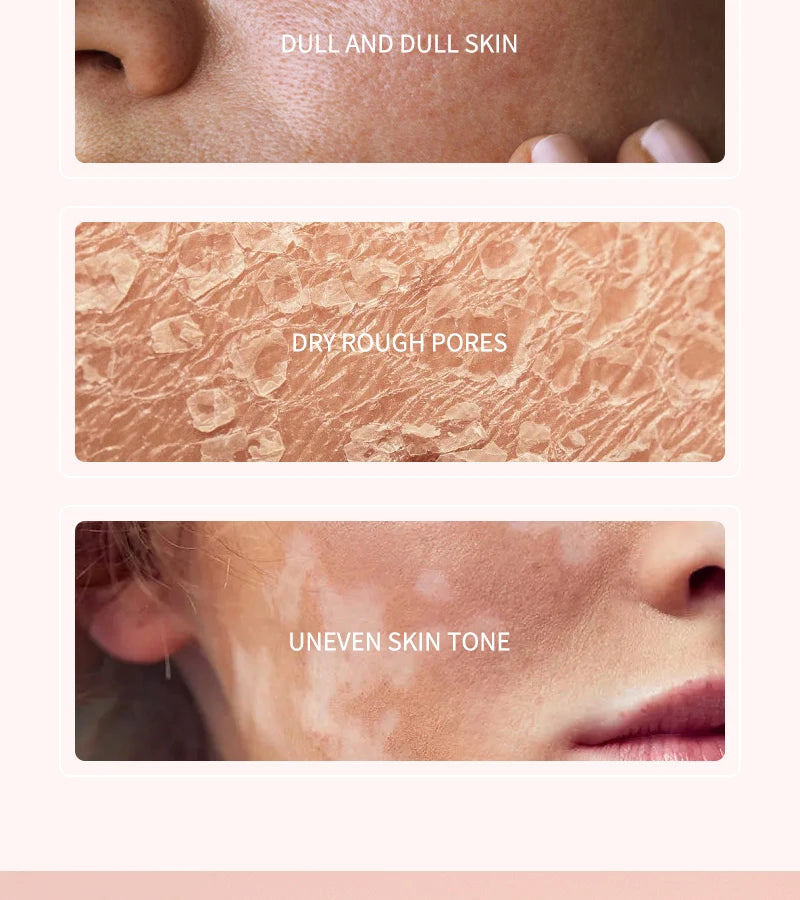 MELAO Niacinamide Serum Whitening Pore Minimizer Vitamin B3 Hydrating with Zinc Hyaluronic Acid Vitamin C & Licorice Extract - Theresia Cosmetics - skin treatment - Theresia Cosmetics