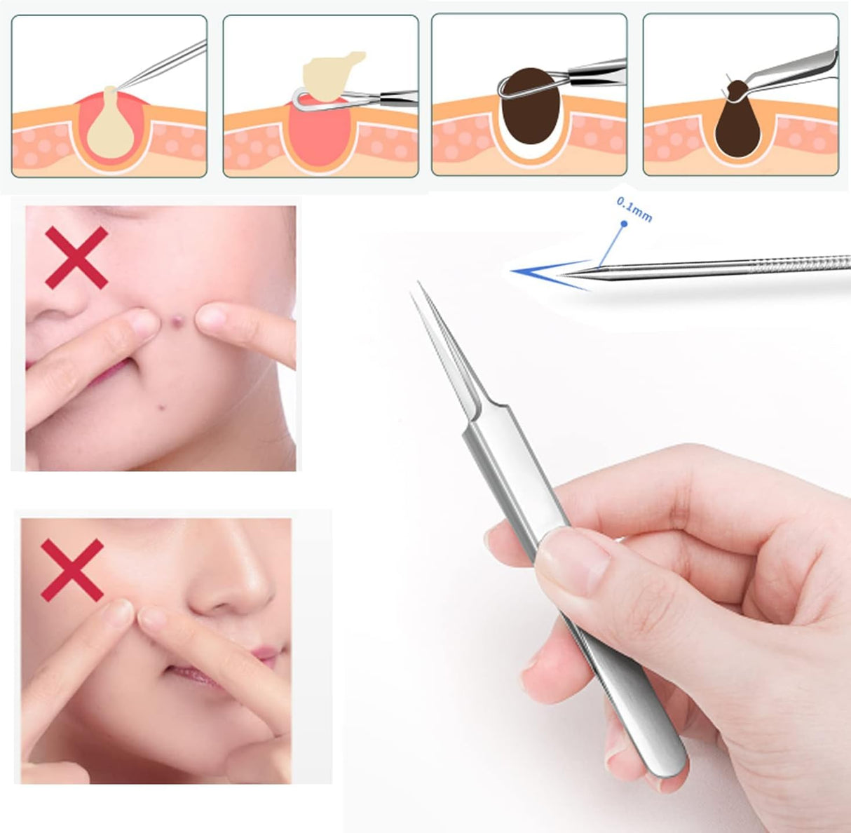 Pack of 6 Blackhead Remover with Storage Box