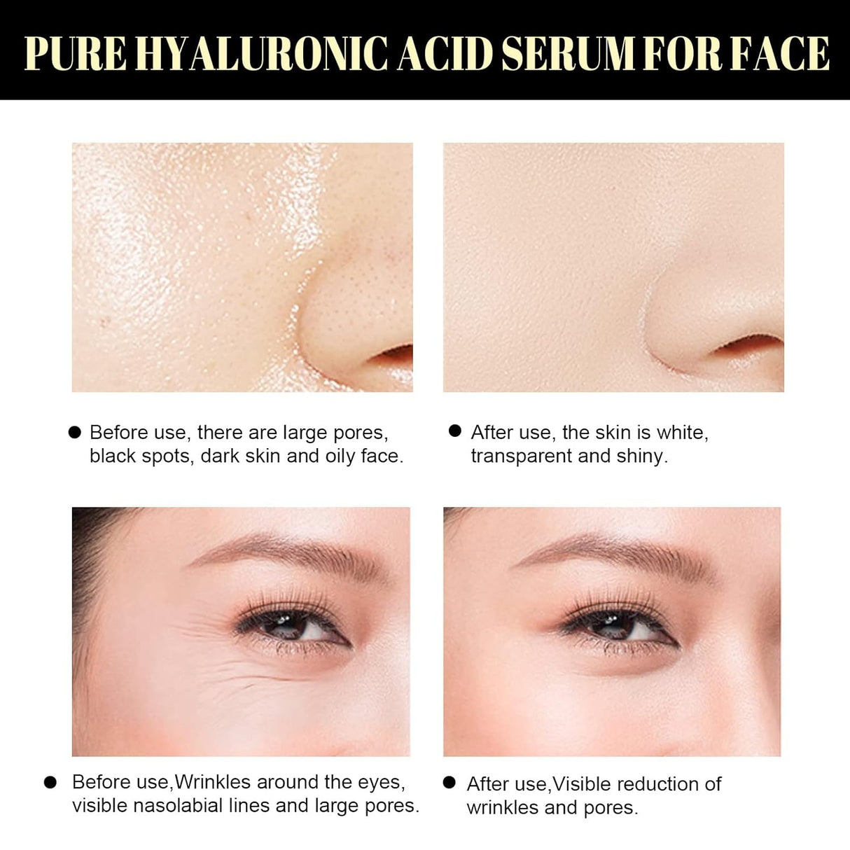 Protein Thread Lifting Set – Collagen Threads & Nano Gold Serum for Face Lift