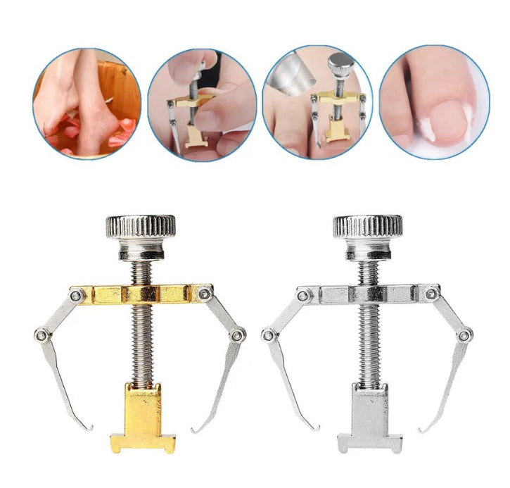 Ingrown Toenails Corrector Stainless Steel Nail Straightening Tool Relief Pain Pedicure Tool For Ingrown Toenail Recover - Theresia Cosmetics - foot care - Theresia Cosmetics