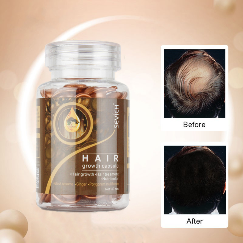 Professional Hair Growth Capsule Oil For Hair Vitamin 30pcs - Theresia Cosmetics - hair growth - Theresia Cosmetics