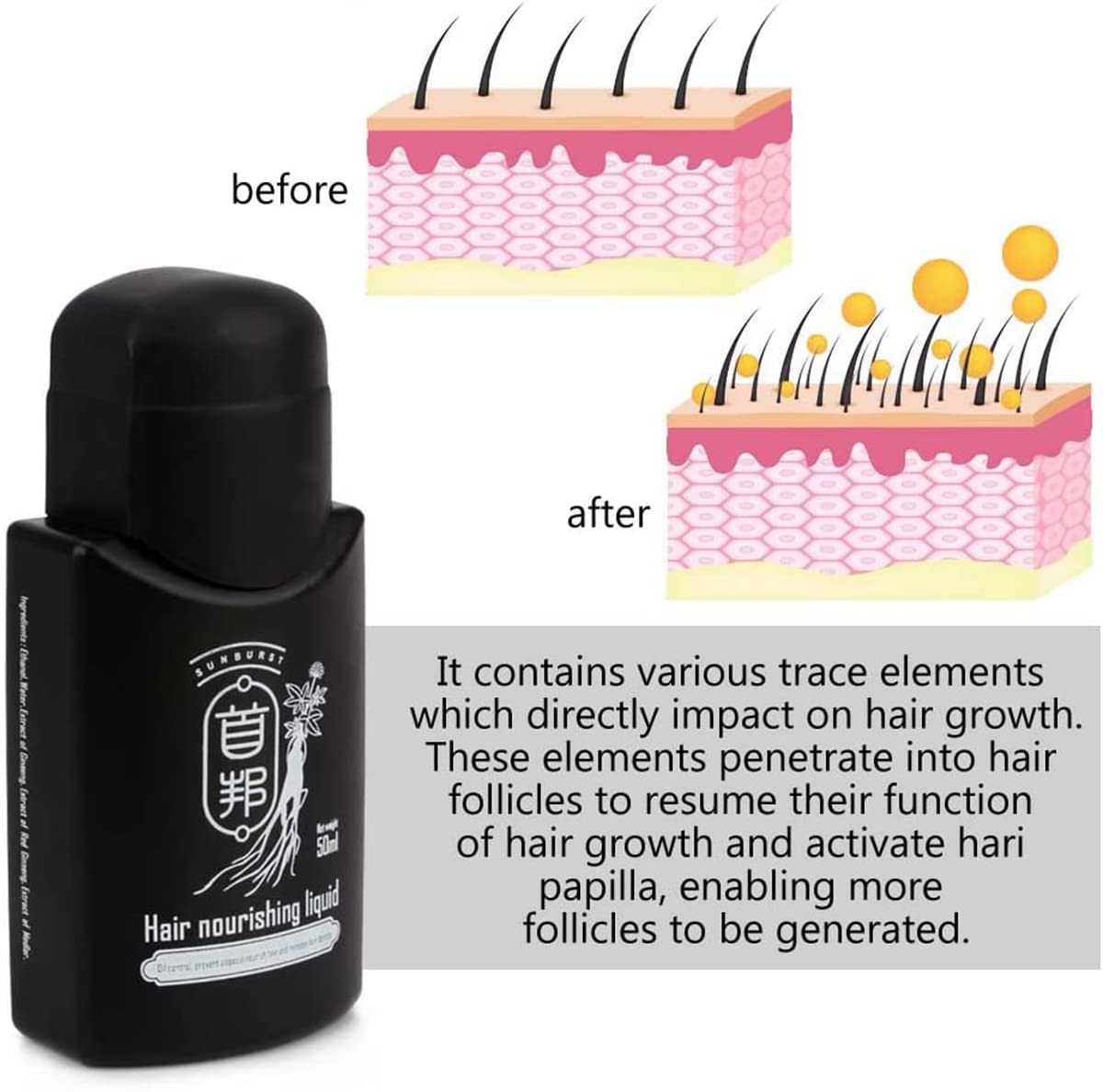 Shou Bang SunBurst Hair Growth Nourishing Liquid - Theresia Cosmetics - hair treatment - Theresia Cosmetics