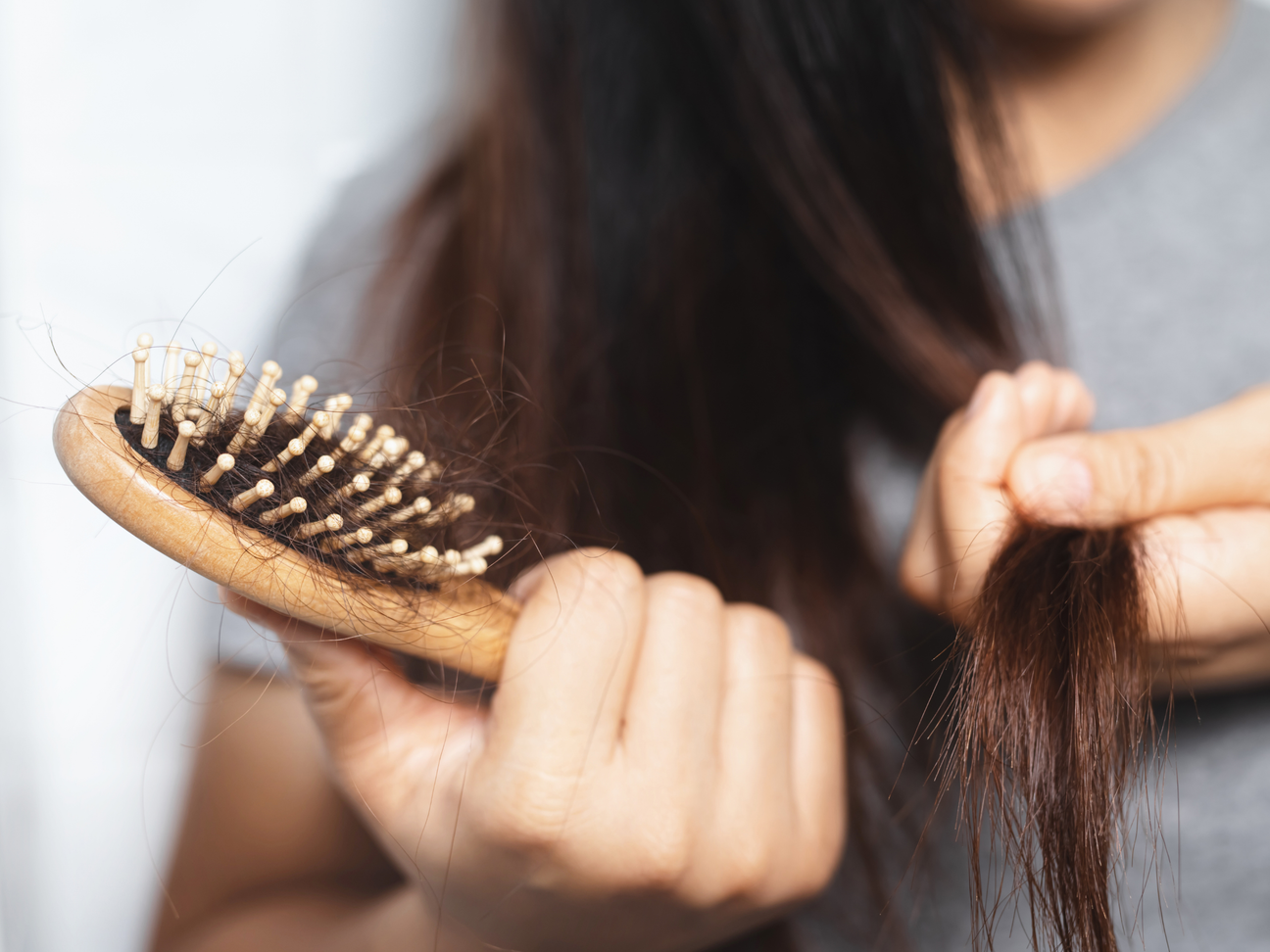 Hair Loss