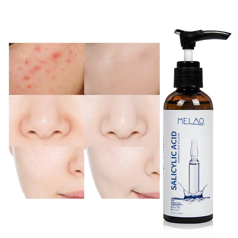 Melao Salicylic Acid Cleaser - For Blemishes and Acne - Theresia Cosmetics - skin care - Theresia Cosmetics