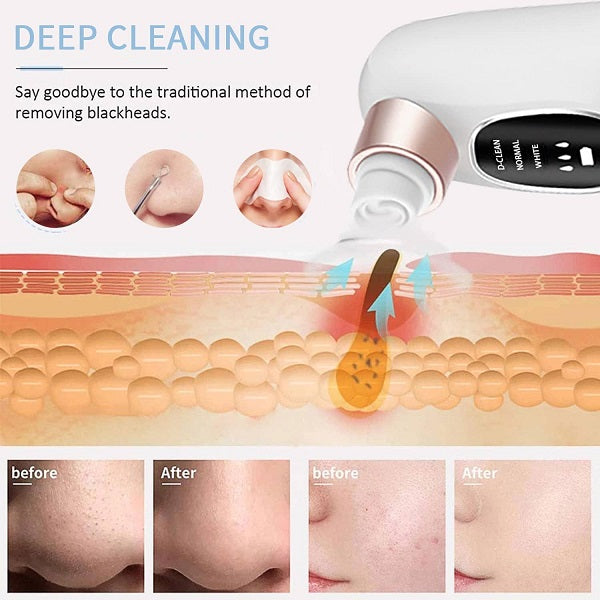 Super Micro Bubble Beauty Instrument blackhead Remover 5 In 1