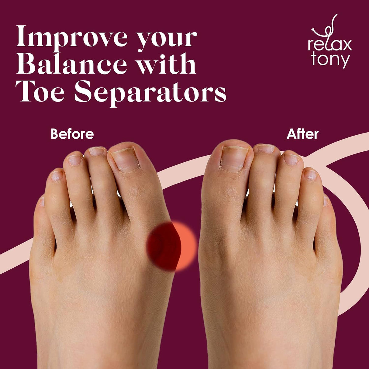 Separators, Straighteners & Spacers For Fitness and Wellness Use | Correct Your Toes Naturally