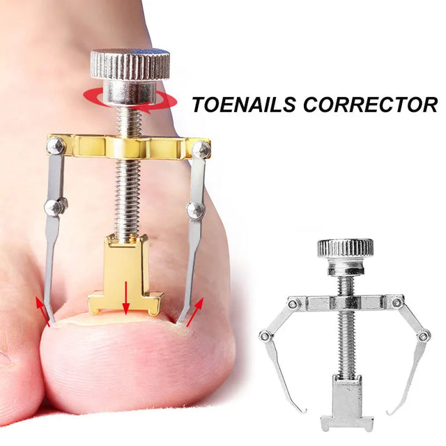 Ingrown Toenails Corrector Stainless Steel Nail Straightening Tool Relief Pain Pedicure Tool For Ingrown Toenail Recover - Theresia Cosmetics - foot care - Theresia Cosmetics