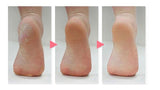 Kemei 316 New Callus Skin Remover Foot Care - Theresia Cosmetics - foot care - Theresia Cosmetics