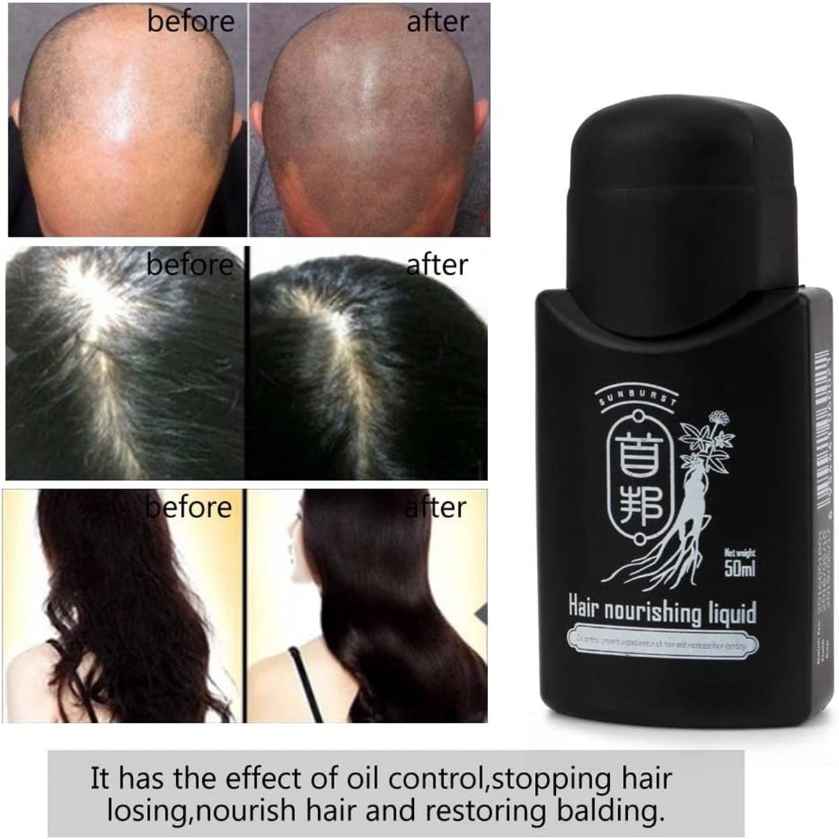 Shou Bang SunBurst Hair Growth Nourishing Liquid - Theresia Cosmetics - hair treatment - Theresia Cosmetics
